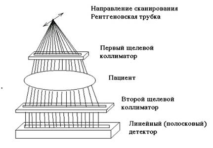 Компьютерная томография